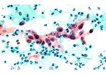 1530245997856340.jpeg th (3).jpg